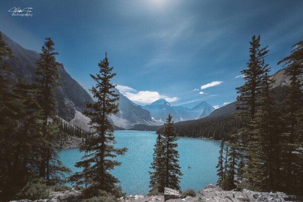 Moraine Lake & Lake Louis